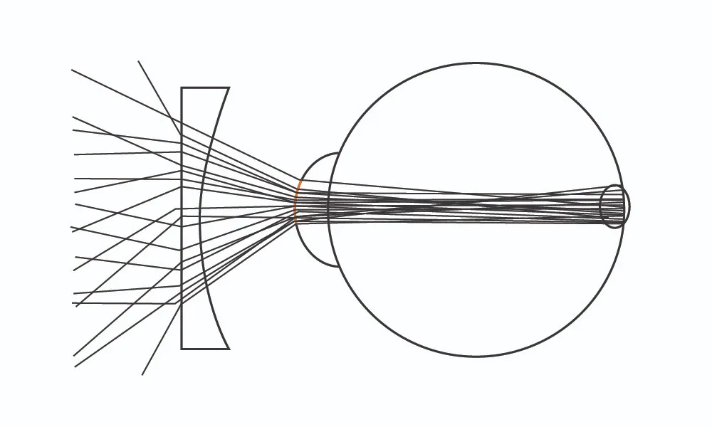 regular lens